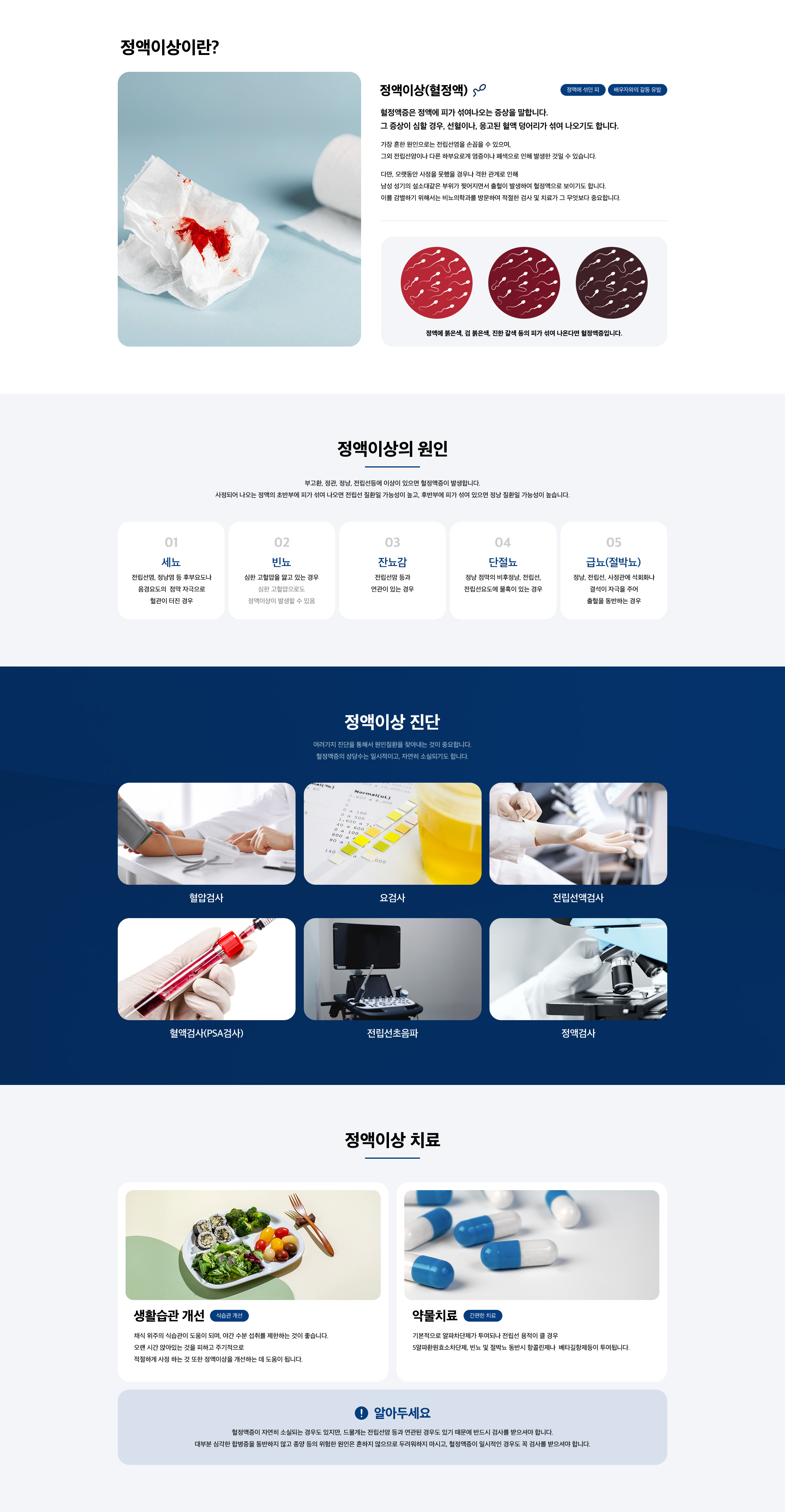 정액 이상